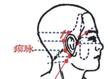 瘛脈穴